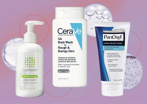 acne products