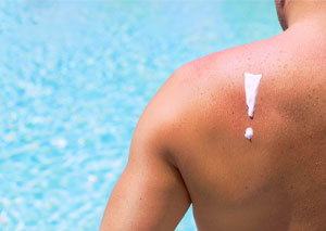 sunscreen on man back